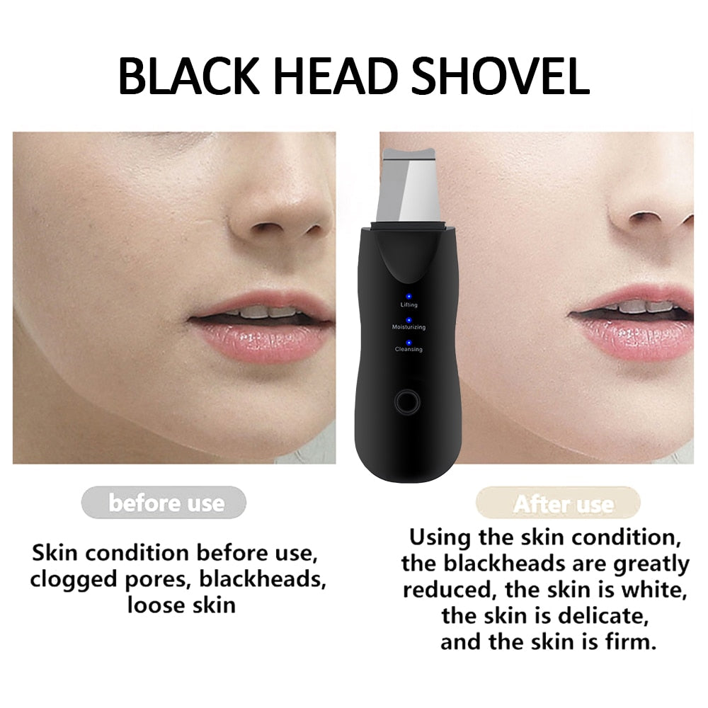 Ultrasonic Skin Scrubber+Blackhead Remover Electric Pore Cleaner+Nano spray Face Steamer+facial massager instrument+Eye beauty